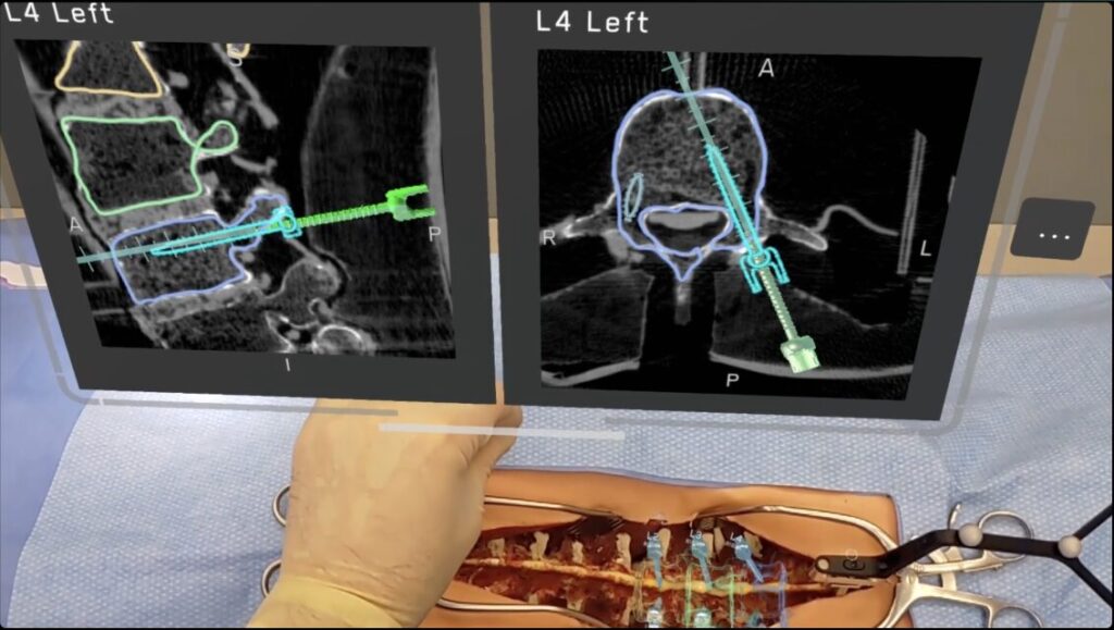 AI hand tracking allows surgeons to control the data in their surgical field, not forcing them to look in only one direction.