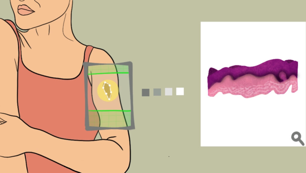 Virtual Biopsy - Stanford University