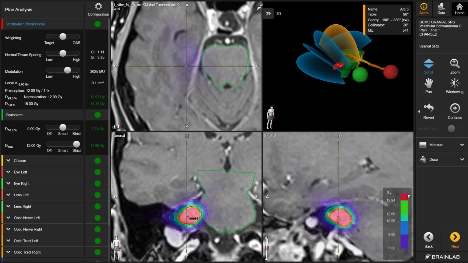 Brainlab Process Brainlab Elements: The Smart Software Revolutionizing Surgery ...