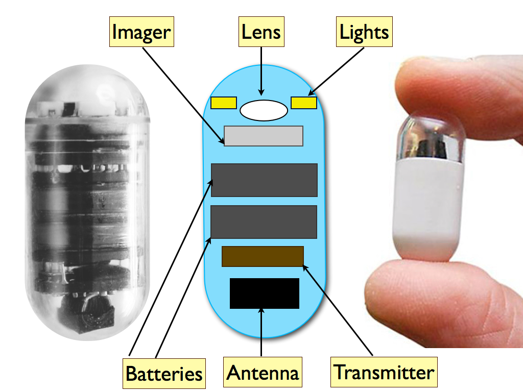 Video capsule details