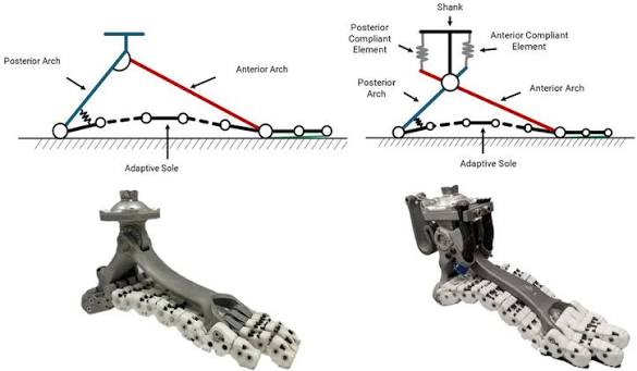 SoftFoot Pro explained